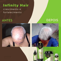Kit Crescimento Capilar Infinity Hair – Tônico + Cápsulas